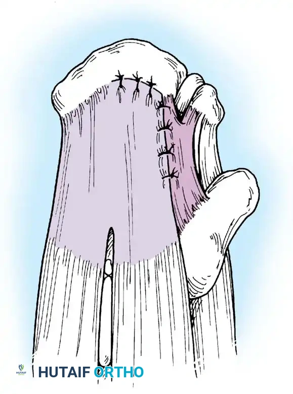 Hutaifortho's Orthopaedic Diagram