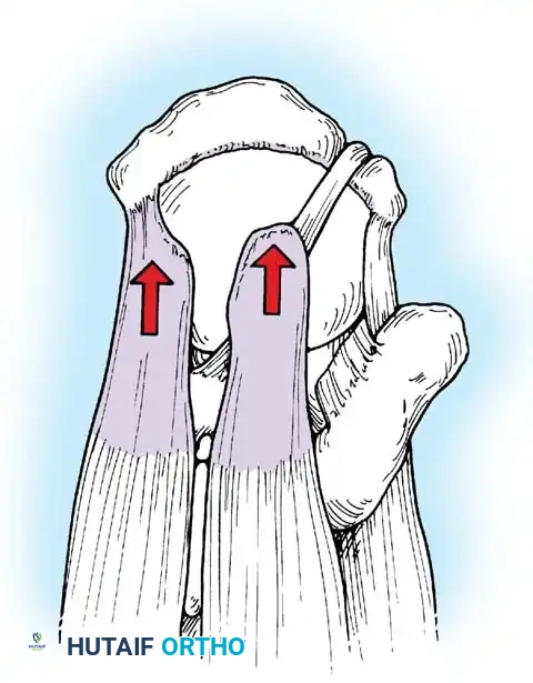 Hutaifortho's Orthopaedic Diagram