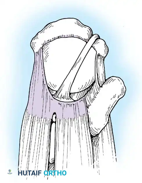 Hutaifortho's Orthopaedic Diagram