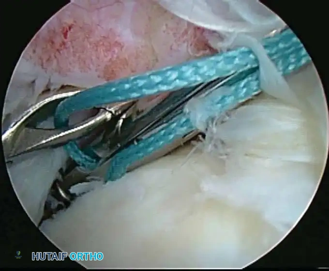 Hutaifortho's Orthopaedic Diagram