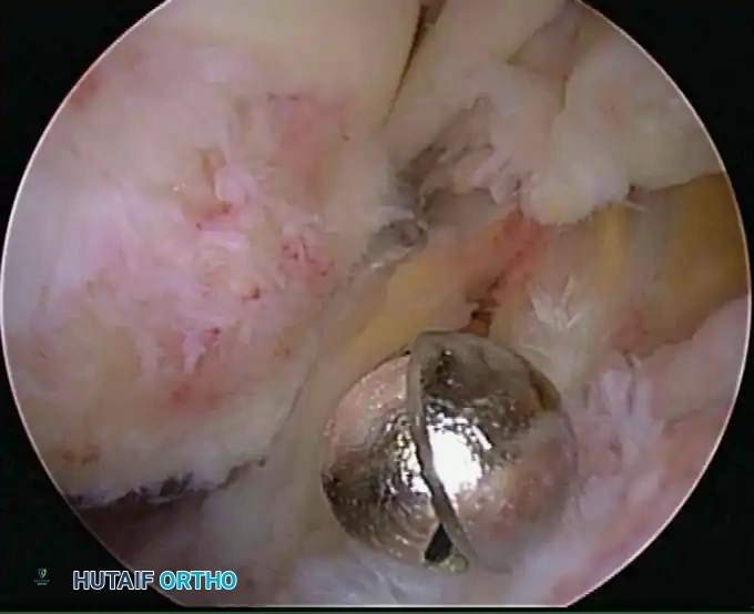 Hutaifortho's Orthopaedic Diagram