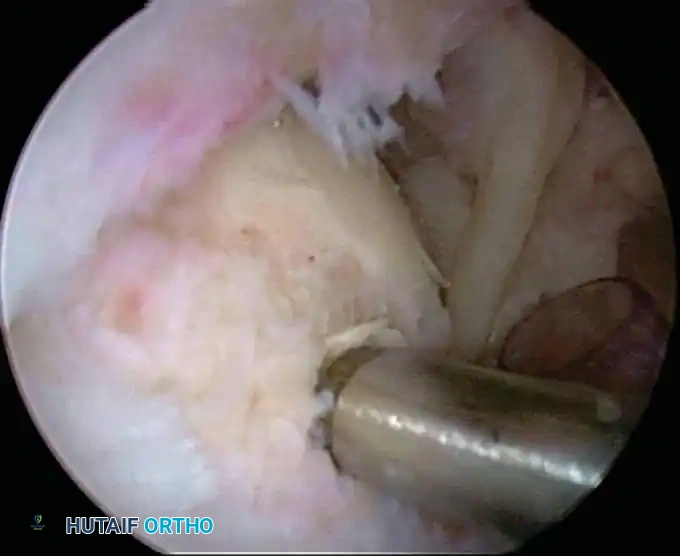 Hutaifortho's Orthopaedic Diagram
