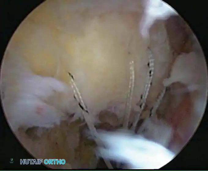 Hutaifortho's Orthopaedic Diagram