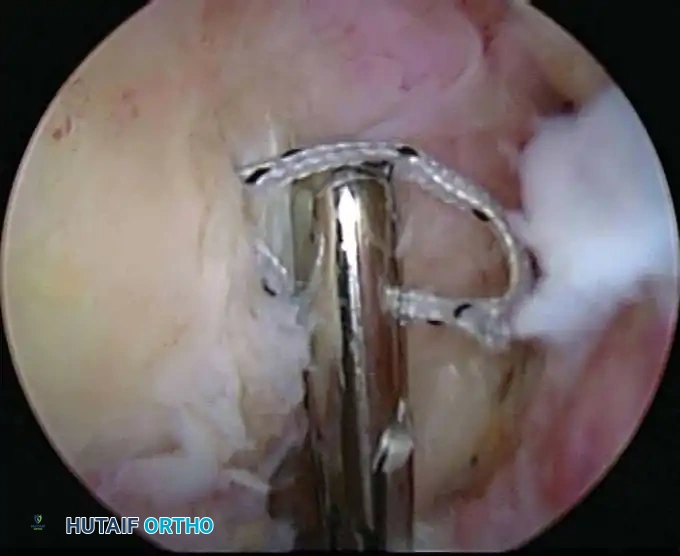 Hutaifortho's Orthopaedic Diagram