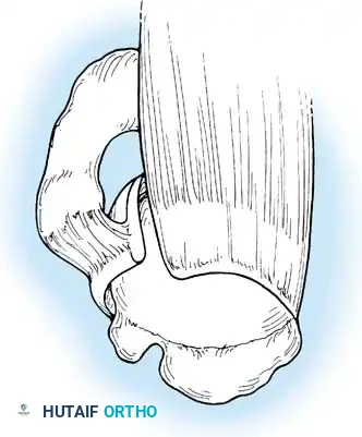 Hutaifortho's Orthopaedic Diagram