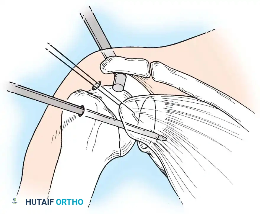 Hutaifortho's Orthopaedic Diagram