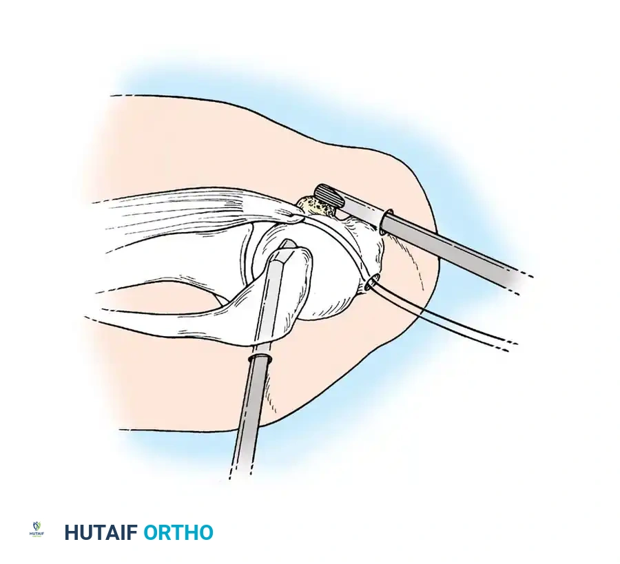 Hutaifortho's Orthopaedic Diagram