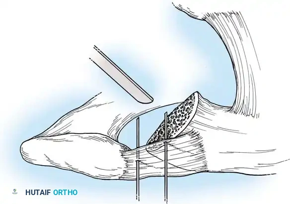 Hutaifortho's Orthopaedic Diagram