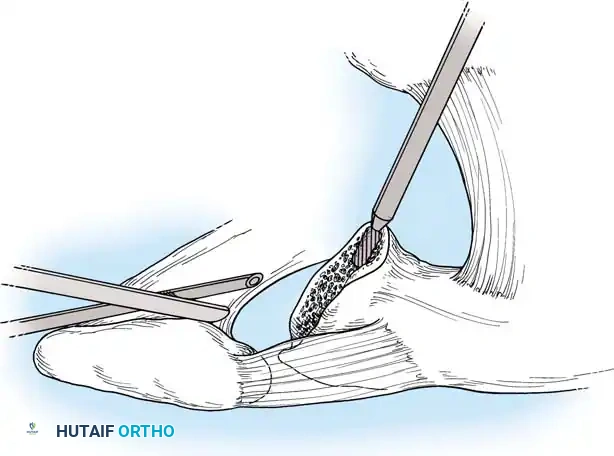 Hutaifortho's Orthopaedic Diagram