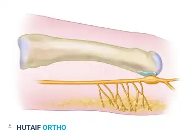 SIGNS AND SYMPTOMS Surgical Diagram