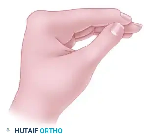 تصميم الشق الجلدي لتقنية الشريحة المنزلقة الظهرية لتصحيح تشوه الإبهام