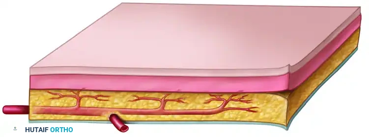 Single-Stage Tissue Transfer: Principles and Techniques of Free Flaps in Orthopaedics