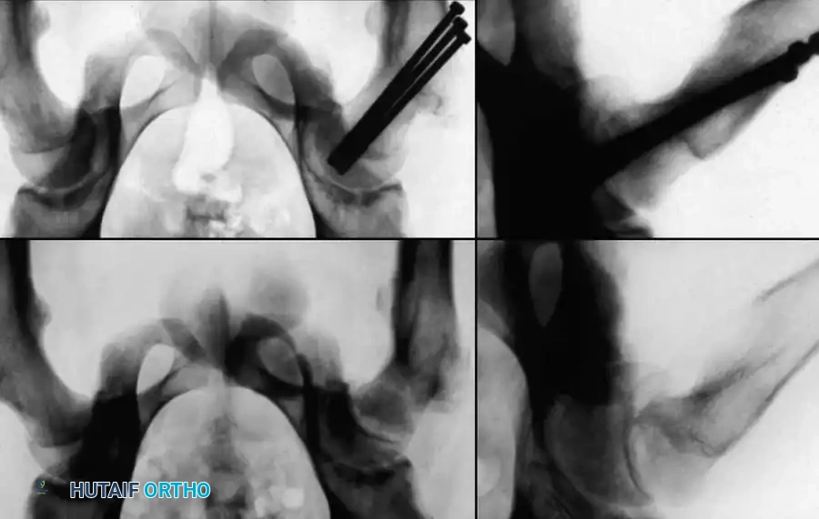 Hutaifortho's Orthopaedic Diagram
