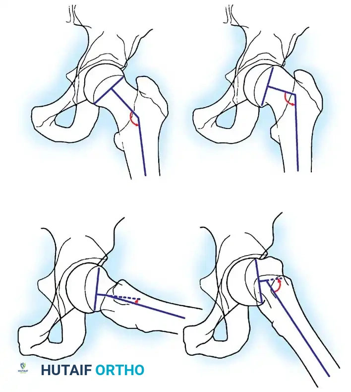 Hutaifortho's Orthopaedic Diagram