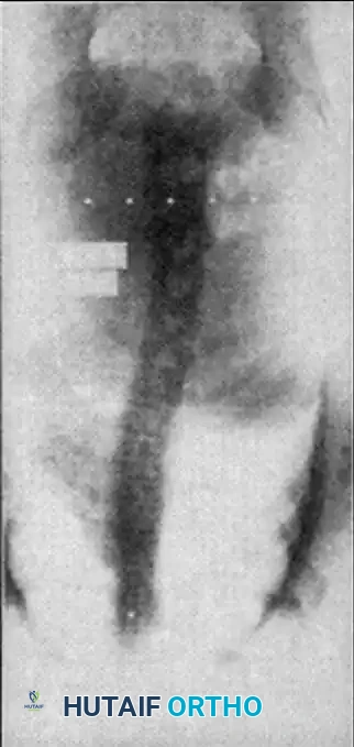 Hutaifortho's Orthopaedic Diagram