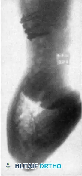 Hutaifortho's Orthopaedic Diagram