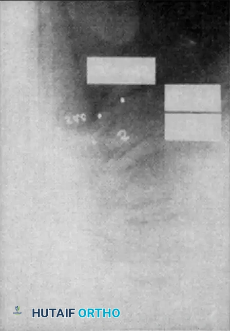 Hutaifortho's Orthopaedic Diagram