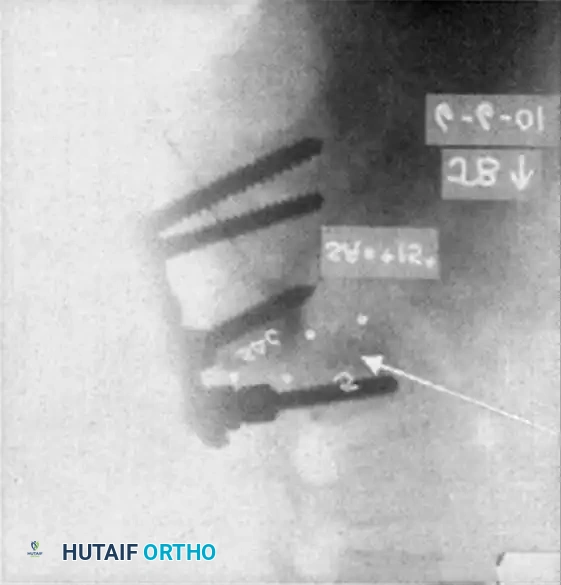 Hutaifortho's Orthopaedic Diagram