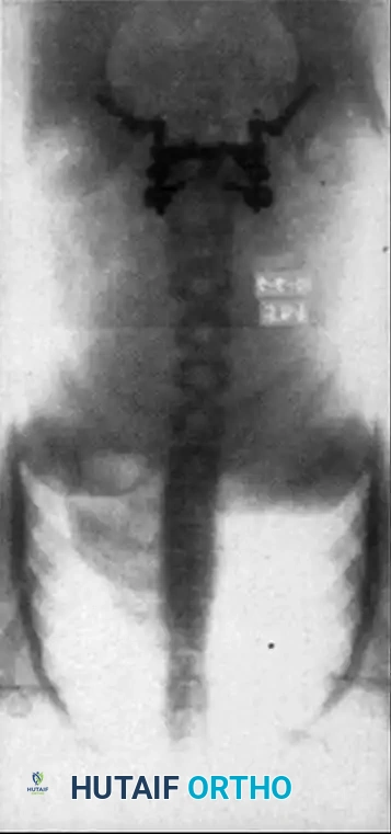 Hutaifortho's Orthopaedic Diagram