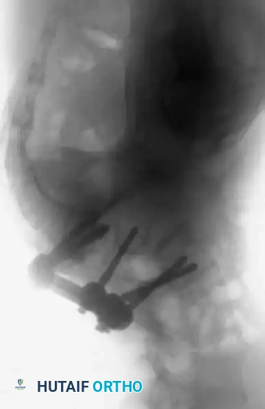 Hutaifortho's Orthopaedic Diagram