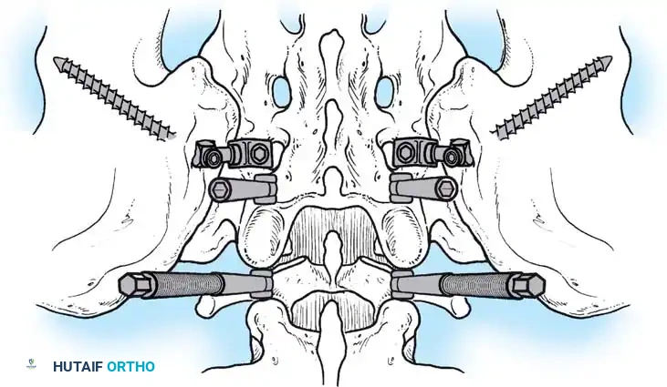 Hutaifortho's Orthopaedic Diagram