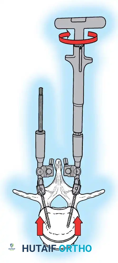 Hutaifortho's Orthopaedic Diagram