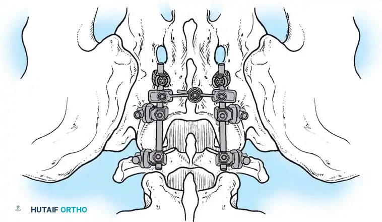Hutaifortho's Orthopaedic Diagram