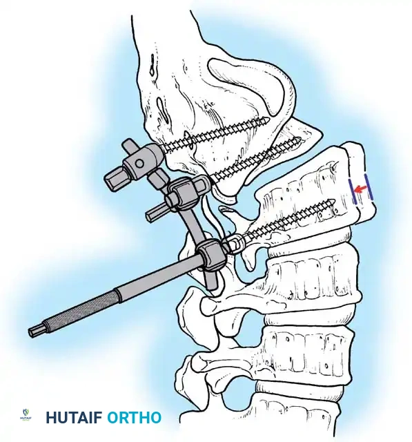 Hutaifortho's Orthopaedic Diagram