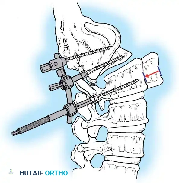 Hutaifortho's Orthopaedic Diagram