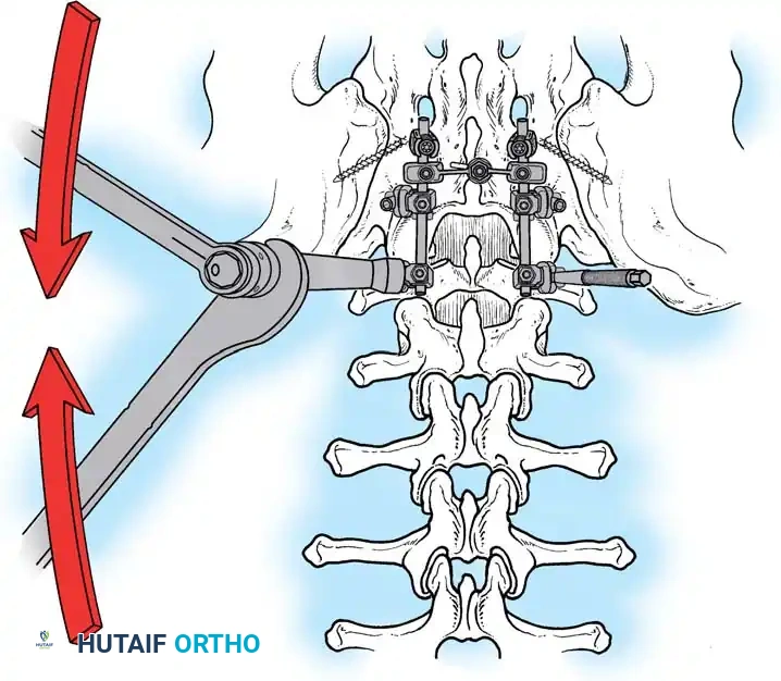 Hutaifortho's Orthopaedic Diagram