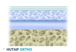 Fasciculation stage 1