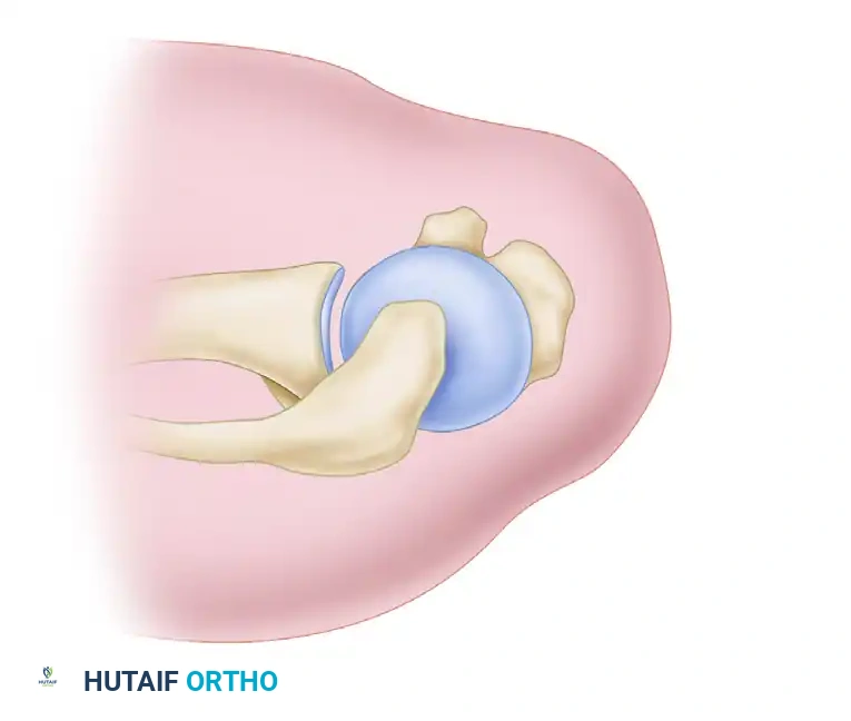 Burkhart and Tehrany portals