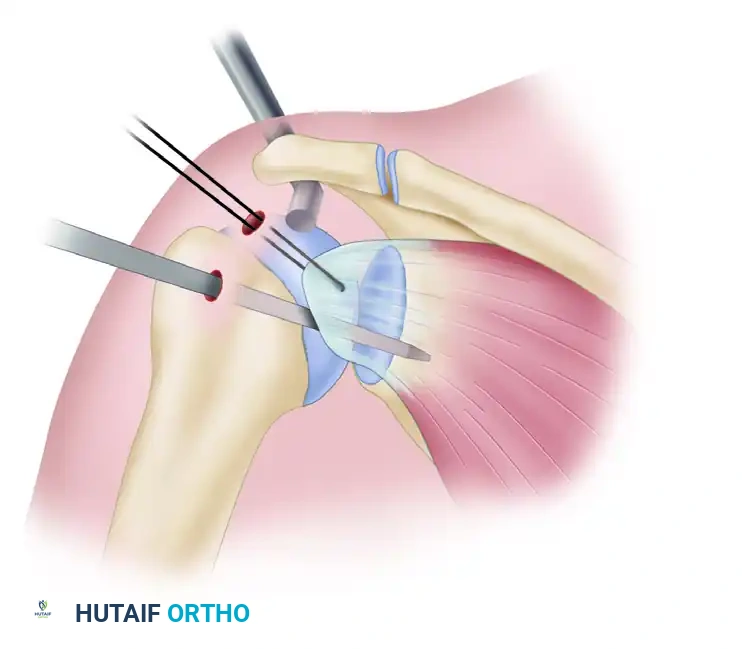 Mobilization superior view