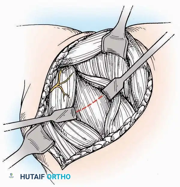 Hutaifortho's Orthopaedic Diagram