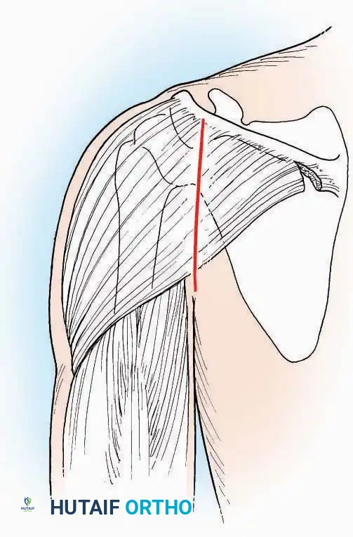 Hutaifortho's Orthopaedic Diagram