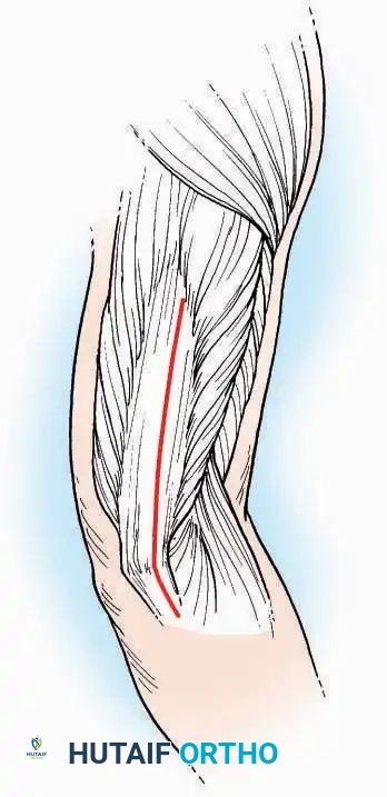 Hutaifortho's Orthopaedic Diagram