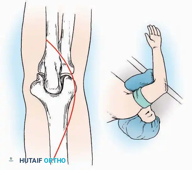 Hutaifortho's Orthopaedic Diagram