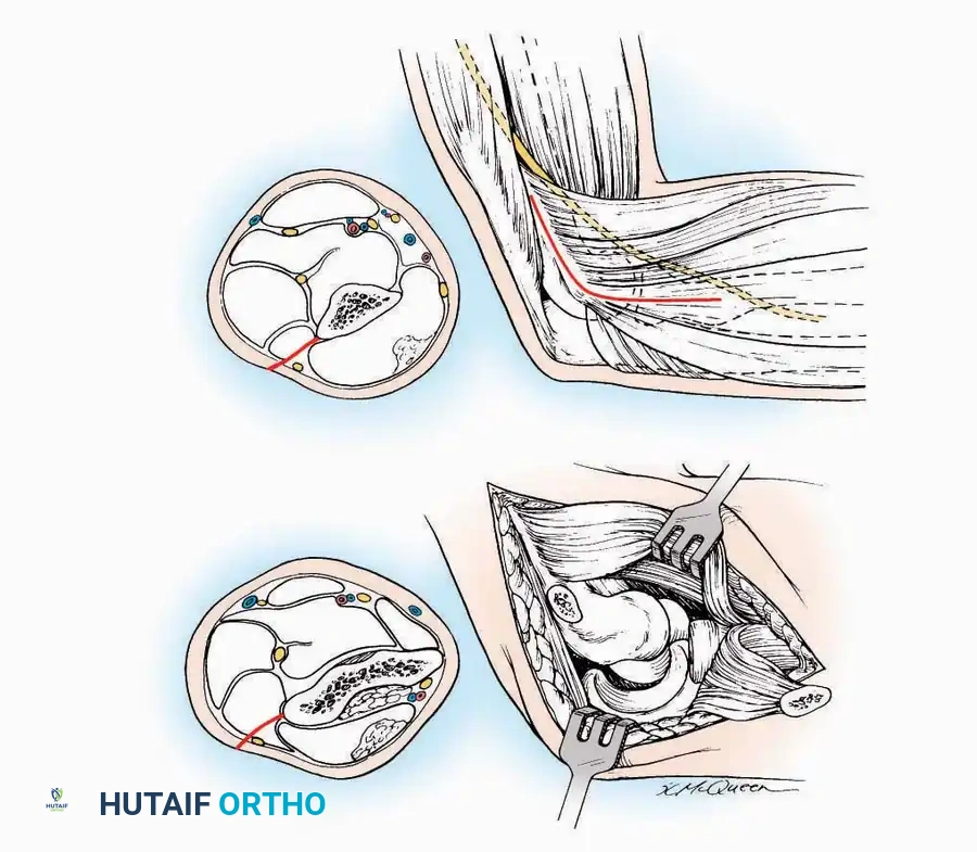 Hutaifortho's Orthopaedic Diagram