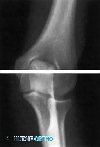 Hutaifortho's Orthopaedic Diagram