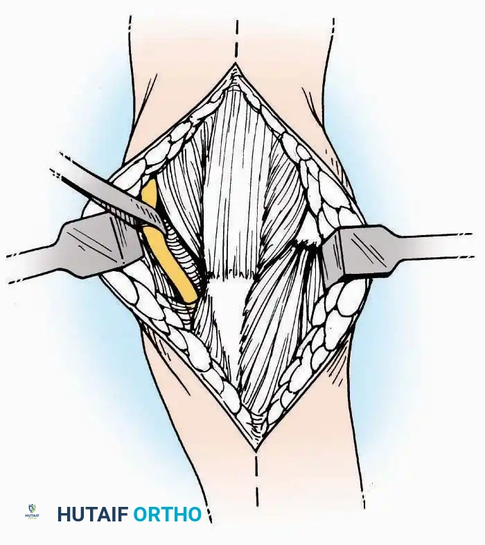 Hutaifortho's Orthopaedic Diagram