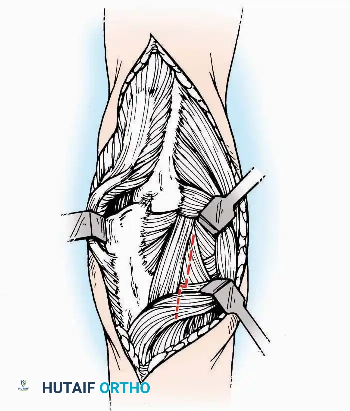 Hutaifortho's Orthopaedic Diagram