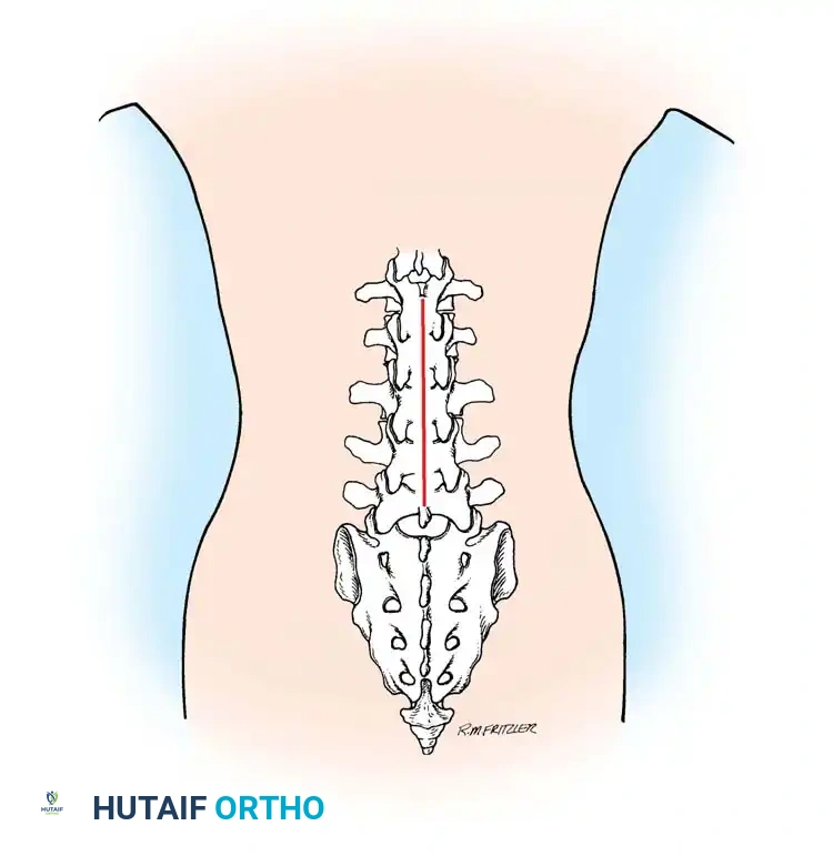 Hutaifortho's Orthopaedic Diagram