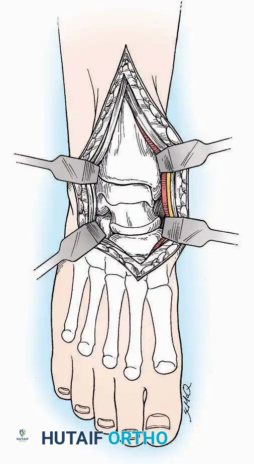 Hutaifortho's Orthopaedic Diagram