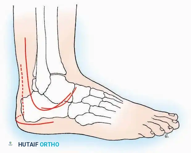 Hutaifortho's Orthopaedic Diagram