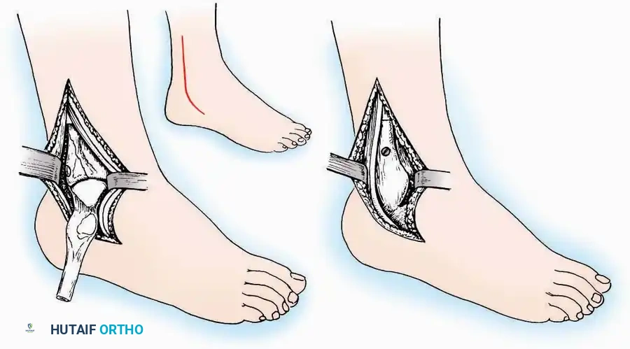 Hutaifortho's Orthopaedic Diagram