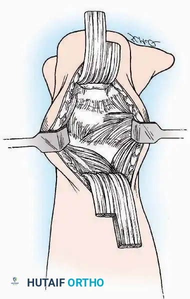 Hutaifortho's Orthopaedic Diagram