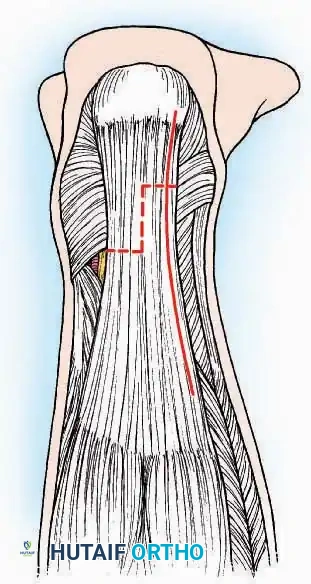 Hutaifortho's Orthopaedic Diagram