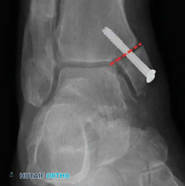 Hutaifortho's Orthopaedic Diagram