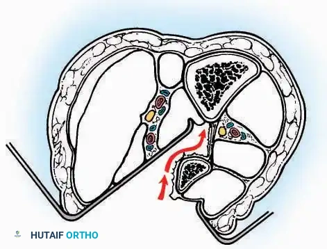 Hutaifortho's Orthopaedic Diagram