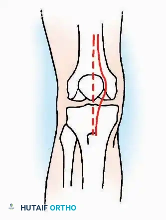 Hutaifortho's Orthopaedic Diagram